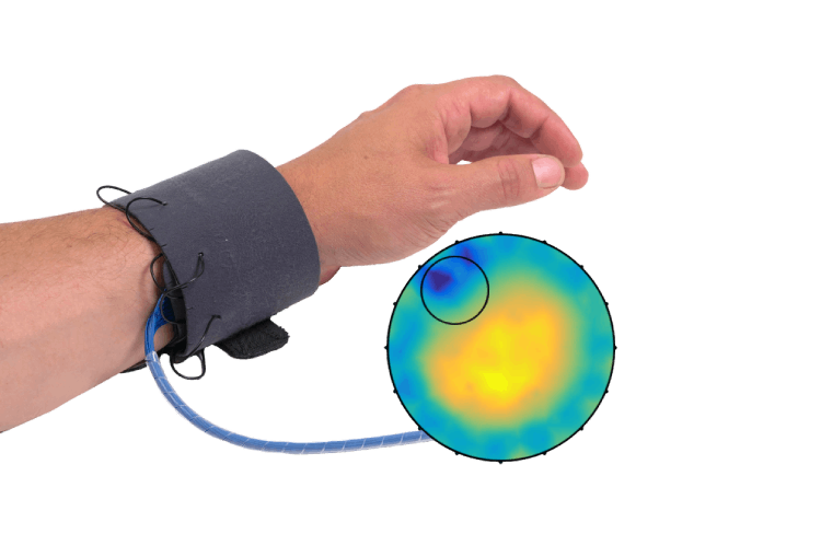 sciospec eit wrist band