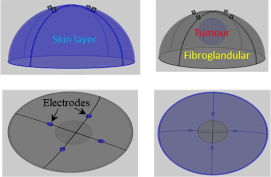 Finite element breast models with and without tumor, visualized in various orientations to support impedance analysis using Sciospec ISX-5.