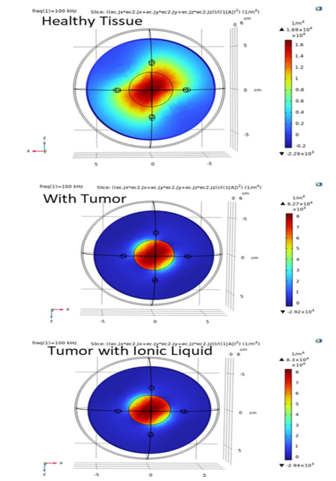 Sensitivity distribution in breast tissue models with and without tumor using ionic liquids, analyzed with the Sciospec ISX-5 impedance analyzer.