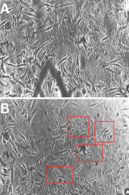 Microscopic images of Vero cells showing control (untreated) morphology and toxin-treated cells with visible vacuolization, observed at 40X magnification.